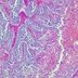 This Liver Condition Affects 100 Million Americans and May Have a Surprising Cause, Says the Mayo Clinic