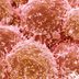 Experts: Only 1 In 5 People Who Need This Cancer Screening Actually Get It