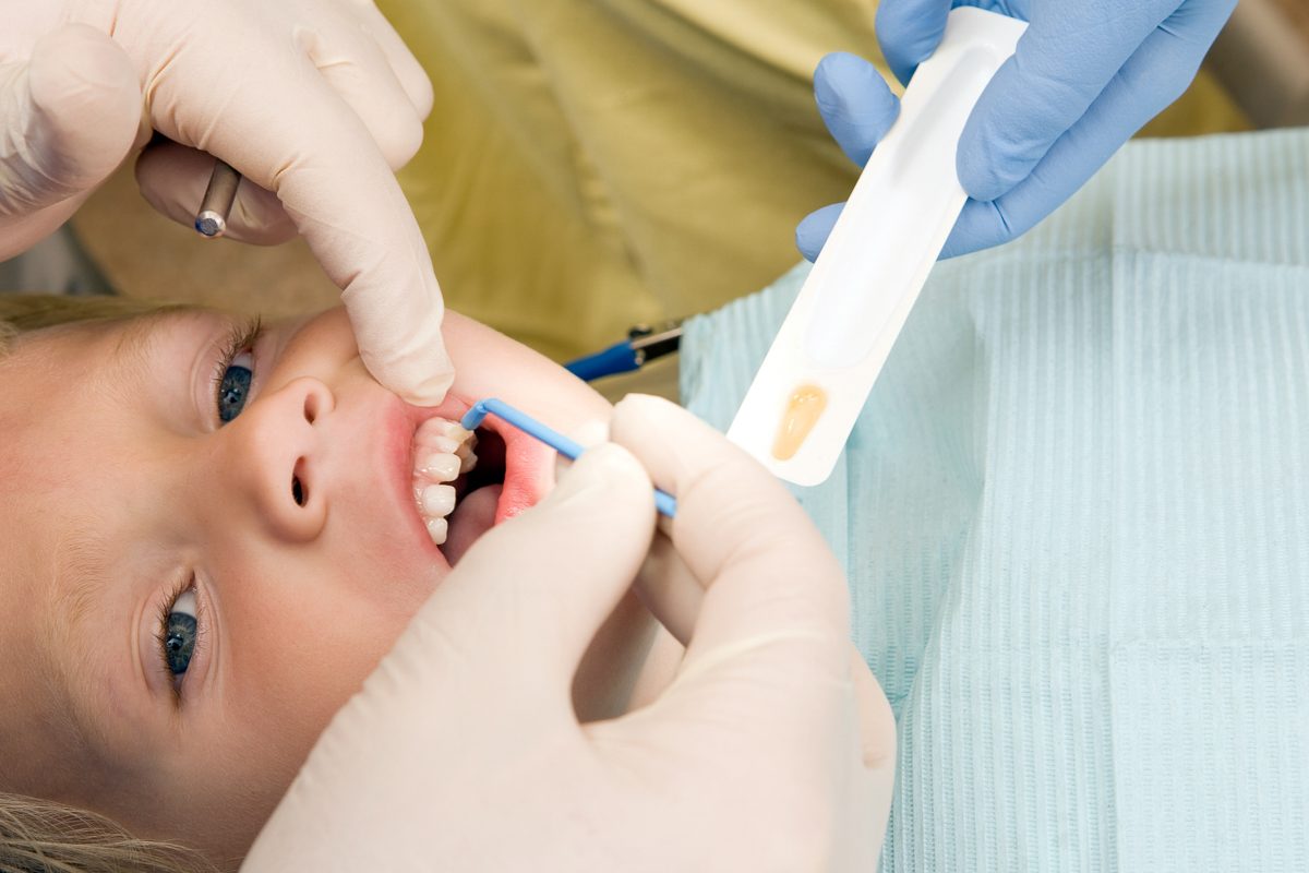 child receiving fluoride treatment from dentist