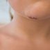 Here's How You Know If You Need Stitches, Says an Emergency Room Doctor
